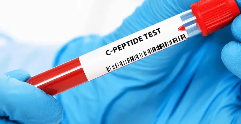 C-Peptide Test Overview and Normal Levels